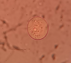Descripción: E:\Articulos Febrero-Mayo\Miscelanea\html\DETERMINACIÓN DE PROTOTHECA SPP. EN VACAS EN PRODUCCIÓN EN DOS ZONAS GEOGRÁFICAS DEL ECUADOR_archivos\image003.png